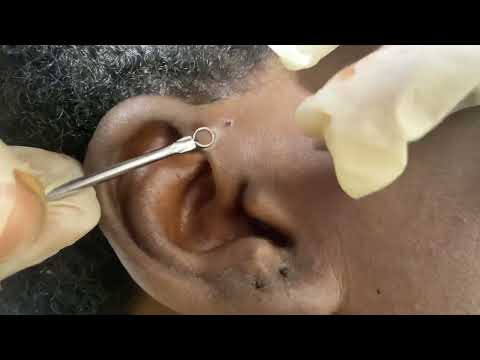 ASMR FAST TO SLOW AGGRESSIVE HEAD SCREAMING MASSAGE, RELAXING EAR CLEANING AND NITPICKING FOR SLEEP
