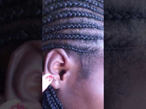 Asmr rare & attentive ear nitpicking #satisfying #earcleaning #deepsleep #deepearcleaning