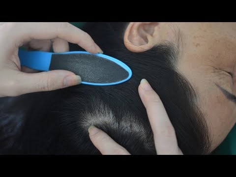 ASMR Nape And Head Scratch No Talking With Snoring, Breathing Sounds For Anxiety Relief