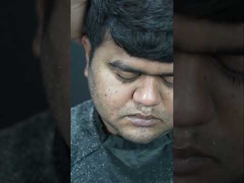 Huge Dandruff Removal And Dandruff Treatment ASMR | Neck Cracking | Comb Massage ASMR #shorts