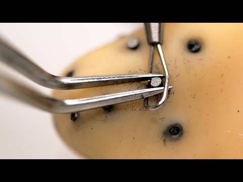 [ASMR] Removes long long blackheads. The moment it comes out is pleasant (subtitles, acne, stones)