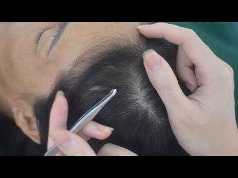 ASMR Tingling Hair Sounds With Scalp Scratching, Scalp Massage, Hair Combing For Relieve Stress