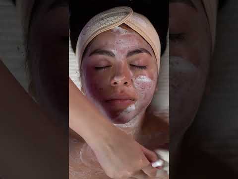 Acne transformation walk-through