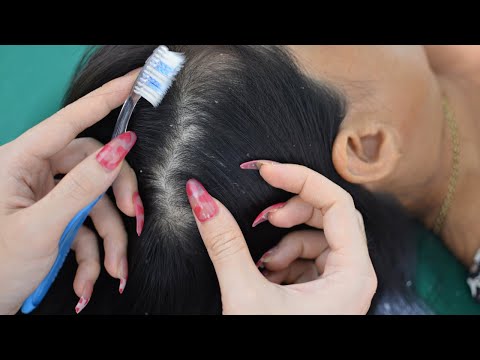 Asmr Relaxing Scalp Check With Toothbrush On Real Person For Sleep ( No Talking )