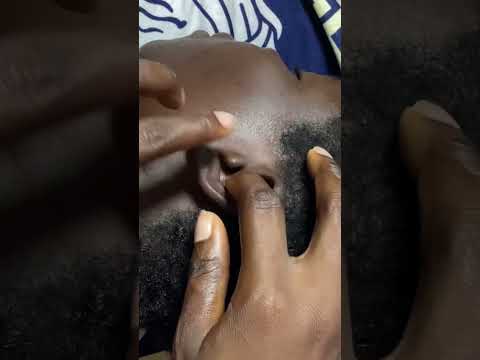 Asmr tingling triggers relaxing ear clearing on a real person #earcleaning #soundmassage #relax