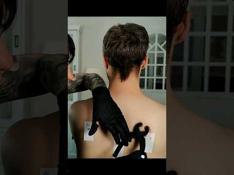 Skin tests on his back