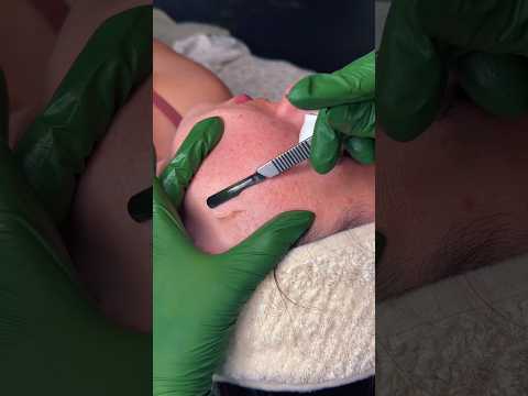 Thought I’d share this Dermaplaning ASMR with you guys 🫶🏼 #ASMR #facial