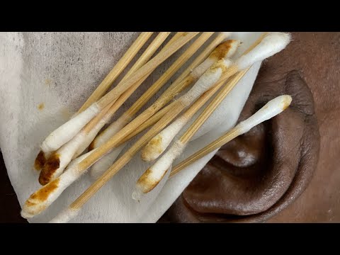 ASMR DEEP EAR CLEANING FOR SLEEP AND RELAXATION