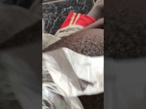 Asmr real dandruff Removal #hair #asmr #headscratching #nitpicking
