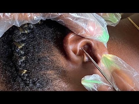 ASMR 🤗 FACE, EAR PIERCING CLEANING- Bubblegum Cracking