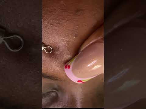 ASMR FACE NITPICKING AND CLEANING FOR DEEP SLEEP #asmr #satisfying #tingling #relax #tinglyfeeling