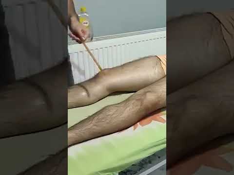 ASMR FRONT LEG DEEP RELAXING MASSAGE THERAPY #relaxationmassage  #massage #relax #postopmassage