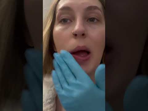 My Skin After 4 months On Accutane (asmr) Doing My Make Up