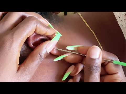 ASMR SUPER ATTENTIVE EAR CLEANING