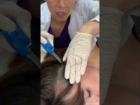 Asmr scalp tingles #asmr #asmrsounds #asmrvideo #relax #relaxing #satisfying #hair #sleep #tingles