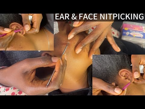 ASMR COME LET ME PUT YOU TO SLEEP WITH THIS EAR CLEANING AND FACE NITPICKING PART 1