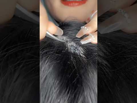 Bugs plucking 🐜🔍 #asmrmassage #asmr #shorts #asmrtingles #asmrsounds