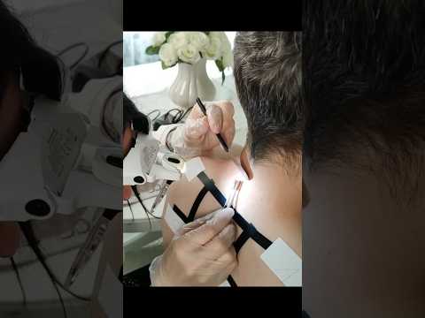 Skin allergy test & analysis
