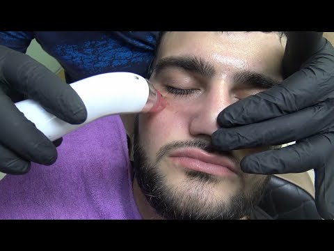 BARBER SKIN CARE - CRACKING - EAR BURN - HOT STEAM - FACE MASK - asmr head, face, ear, neck massage