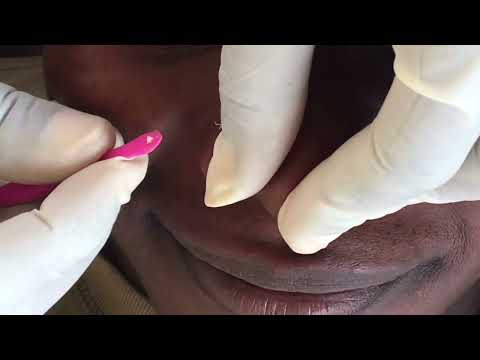 Asmr | Stress Relief , The Tingles 2 #asmr #satisfying  #skincare