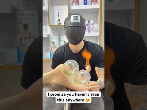 ❤️‍🔥😍#squidgame #shortvideo #shorts #explore #cupping #fire #youtubeshorts #asmr #fyp