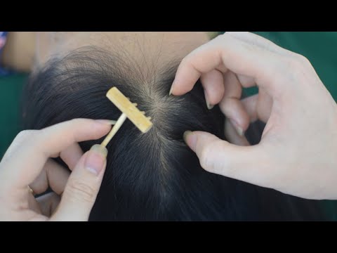 ASMR Melting Scalp Massage, Scalp Scratching Tingles, Hair Brushing For Insomnia ( No Talking )