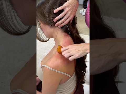 How I Minimize and Reverse the "Hump" #chiropractor #asmr
