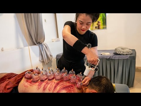 ASMR 🇻🇳 I Didn't Expect to Meet Such a Beautiful Therapist in Vietnam | Vacuum Cupping & Relaxation