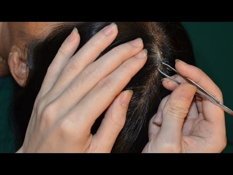 ASMR Relaxing Scalp Check, Scalp Scratching For Real Person Make You Feel Sleep Faster
