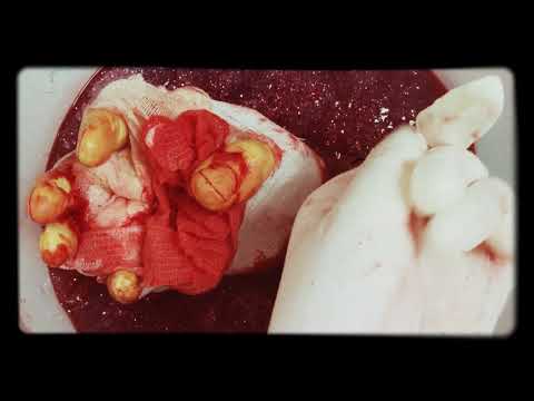 LATEX GLOVES🌚  with ZOMBIE SLIME👀 gauze bandage💉blood ♥  LAYERING [[ASMR]]
