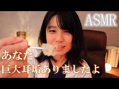 【ASMR】巨大耳くそ！？😲💥 耳掃除Drの耳かき ロールプレイ Giant earwax ear cleaning  Riesige Ohrflecken Ohrenreinigung【30min】