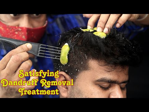 Dandruff Removal ASMR Treatment | Dandruff Removal Satisfying | ASMR Shampoo Massage Comb Massage