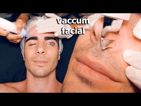 ASMR: Ho Provato un Massaggio Facial con Vaccum per la Rimozione dell'ACNE Brufoli e Punti Bianchi!