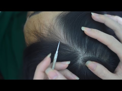 ASMR Real Person Head And Scalp Scratching With Hair Parting Sounds For Reduce Stress
