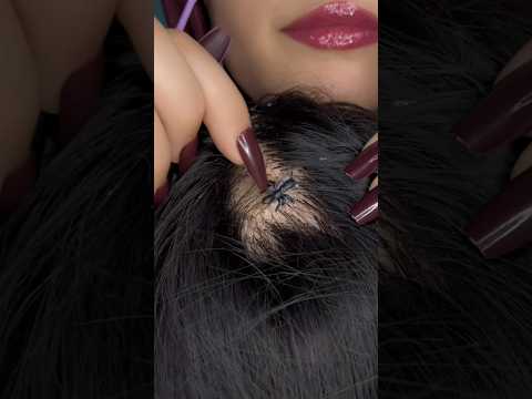 This was hiding in her hair… #shorts #asmr #satisfying #lice #scalp #oddlysatisfying