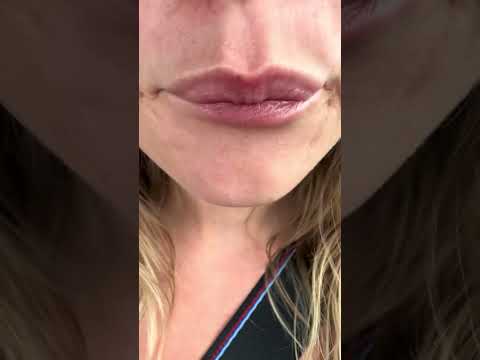 Would you like a kiss?