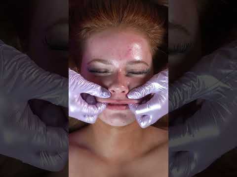 Facial Massage Secret: You Won't Believe What I Ate Before! #shorts