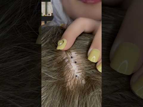 Is this a bug? 🐜 #asmr #satisfying #asmr #asmrmassage #relax #asmrscratching #tingles #shorts
