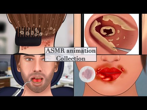 ASMR animation collection|| scalp, head lice, dental implant, lip care, ear wax removal||