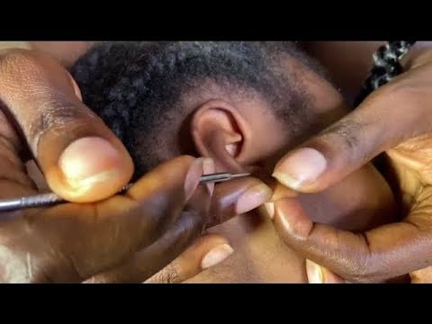 ASMR RELAXING EAR CLEANING HEAD MASSAGE NITPICKING, SCALP SCRATCHING AND MASSAGE WITH GUM CHEWING