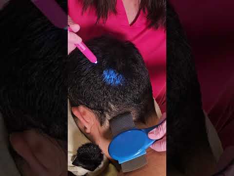 ASMR Scalp Scratching, Soft Hair Brushing, and Calming Head Massage for Relaxation - Real Person