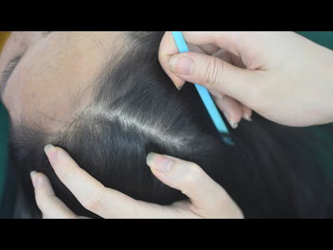 ASMR Real Person Scalp Scratching & Head Massage, Relaxing Hair Tingly For Headache Relief