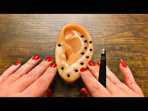 ASMR-Ear Cleaning/Blackhead Removal.. Mouth Sounds & wooden frog sounds 👂🐸