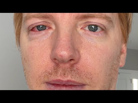 ASMR But I’m Sick As Hell