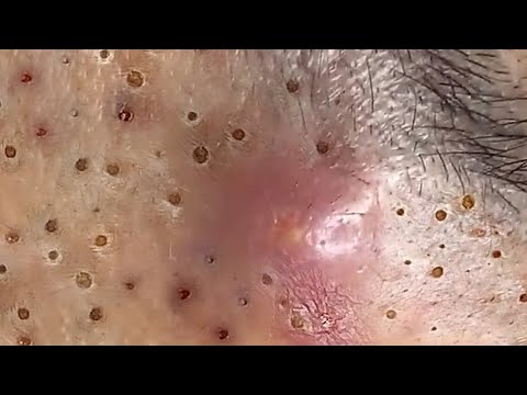 حلول طبيعية لبشرة صافية# 𝐒𝐤𝐢𝐧 𝐂𝐚𝐫𝐞 56633