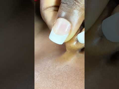 Asmr deep ear hole cleaning #relax #asmr #tingling #satisfying