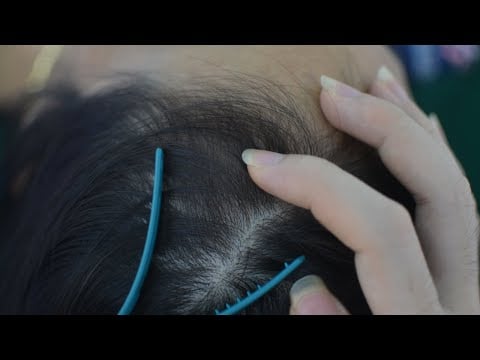 ASMR Real Person Scalp Scratching, Hair Parting, Hair Tingles For Stress Relief ( Asmr No Talking )