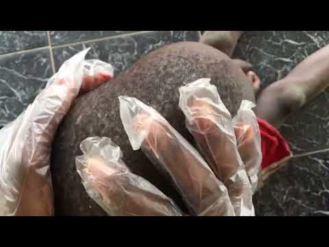 Asmr Scratching dandruff #asmr #nitpicking #scratching #scratch