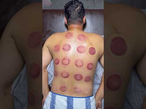 ASMR Cupping Peperoni😍🍕#cupping #viral #cuppingtherapy #asmr #youtubeshorts #shorts #explore