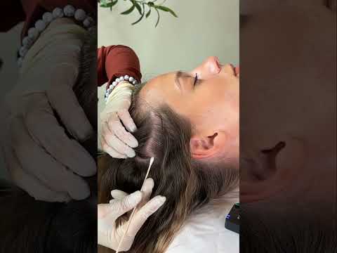 Asmr scalp tingles #asmr #asmrsounds #asmrvideo #relax #relaxing #satisfying #hair #sleep #tingles